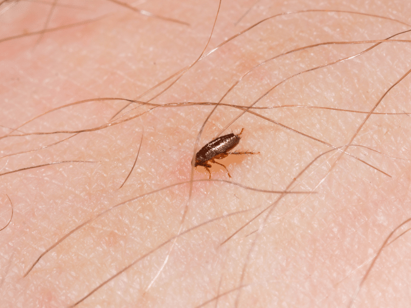 Flea control food industry Toronto showing a flea on skin highlighting contamination risks requiring professional Pesticon pest control